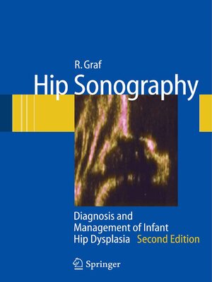 cover image of Hip Sonography